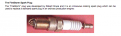 Click image for larger version

Name:	Screen shot 2011-05-22 at 22.30.26.png
Views:	93
Size:	55.7 KB
ID:	450569