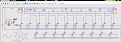 Click image for larger version

Name:	Fig 20 step cir Resistors.jpg
Views:	41
Size:	101.9 KB
ID:	458479